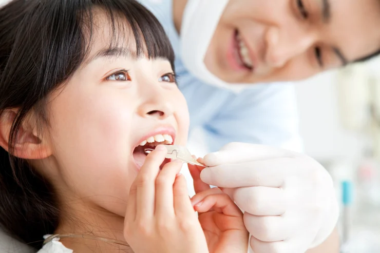 小児矯正 マウスピース治療 子ども向け 取り外し可能 始めるタイミング いつ